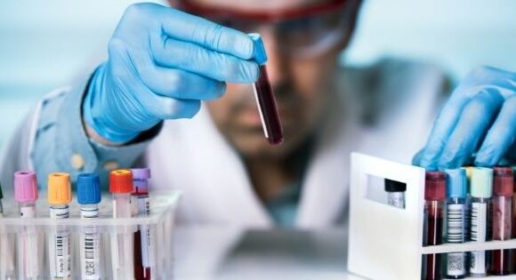 Laboratory Analysis